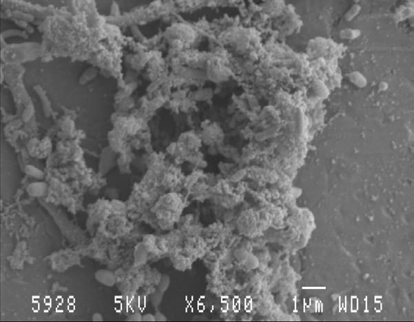 Biofilm behandelt mit 1 ppmWATERBestDes , Einwirkzeit >> 20 min. Biofilm behandelt mit 1 ppmWATERBestDes , Einwirkzeit >> 20 min.