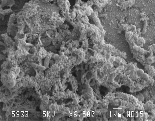 Biofilm unbehandelt Biofilm unbehandelt